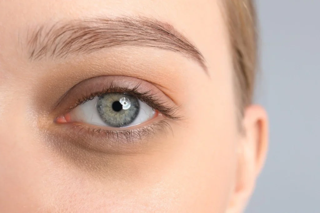 Under Eye Dark Circles Treatment in Austin, TX, at Glo Med Spa
