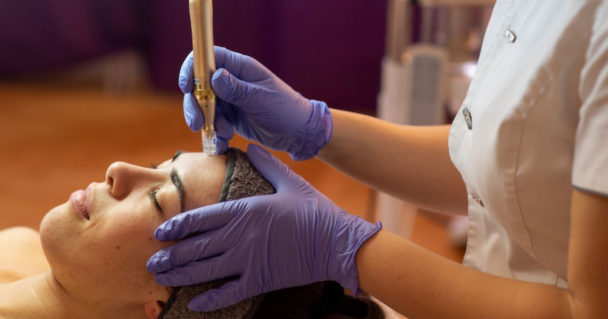 Close-up of a technician using a microneedling pen to stimulate collagen production for smoother, radiant skin.