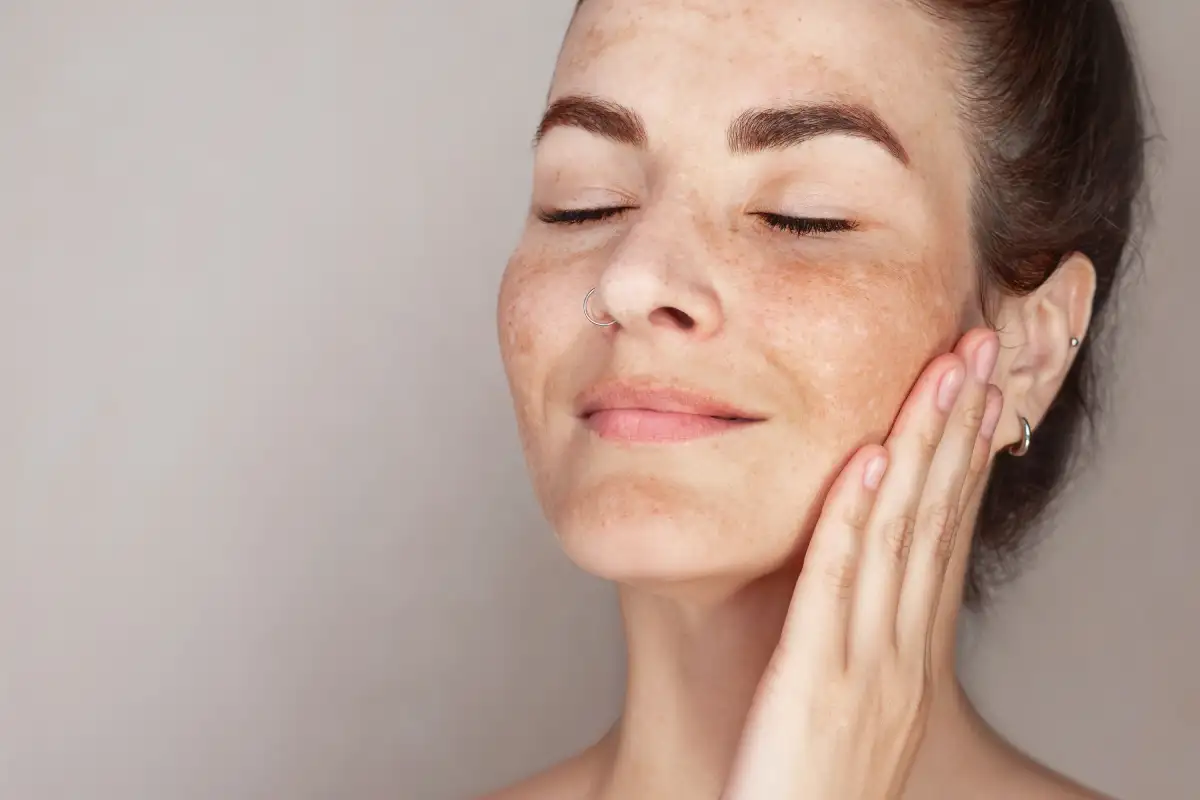 Age Spots Treatment Specialist in Austin TX, at Glo Med Spa