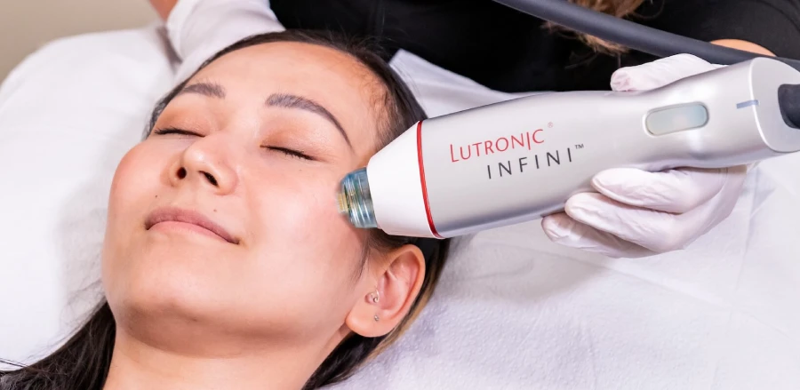RF Microneedling in Austin, TX at Glo Med Spa