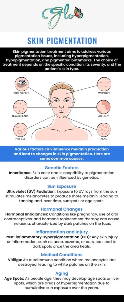 Rosacea and Skin Pigmentation Treatment In Austin, TX, at Glo Med Spa