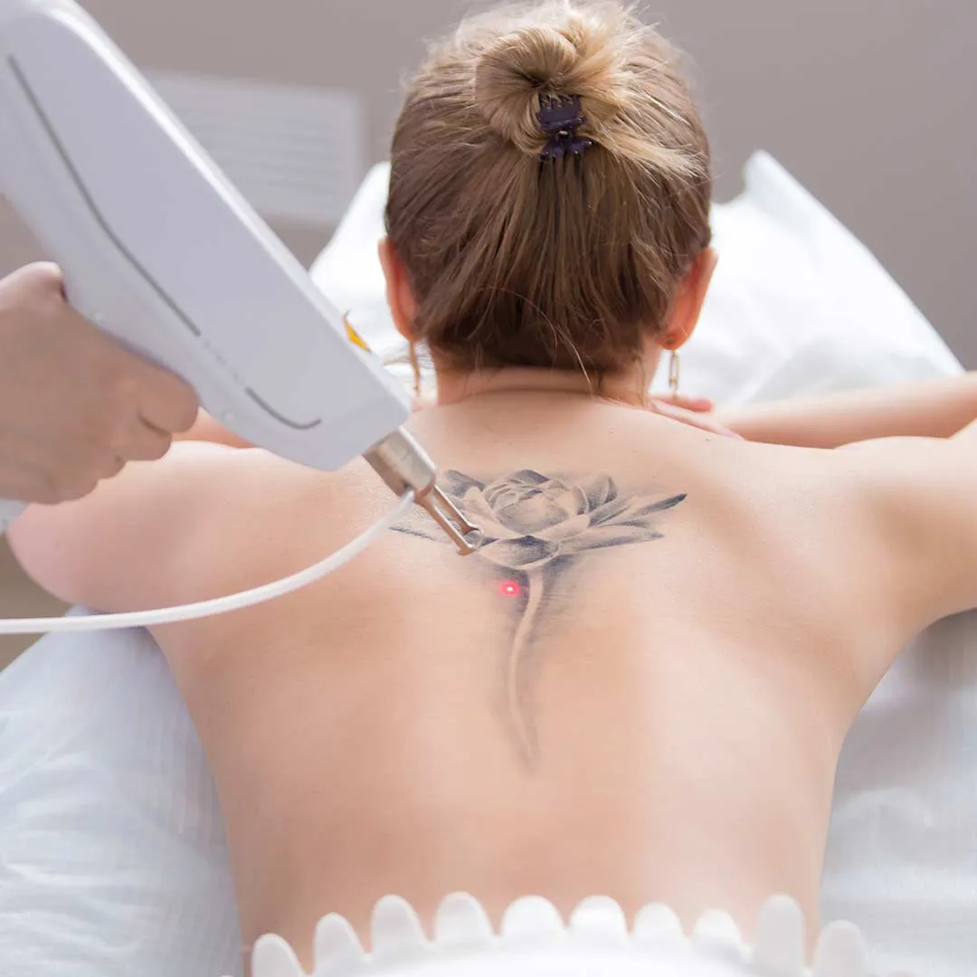 Pico Laser in Austin, TX at Glo Med Spa