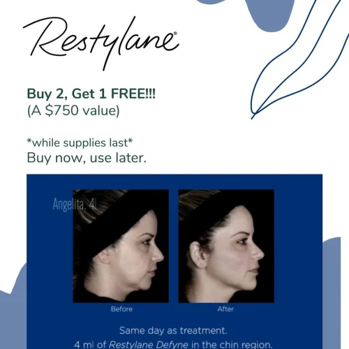 Restylane Offers at Glo Med Spa in Austin, TX