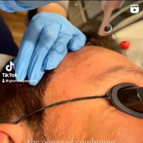 Glo Med Spa TikTok post